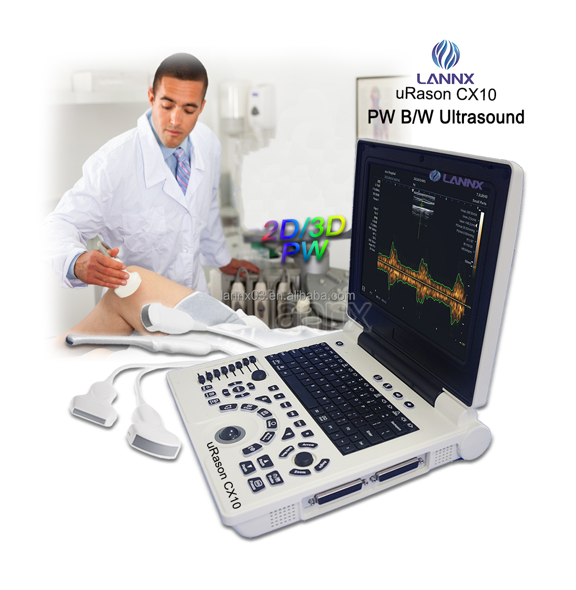 LANNX uRason CX10 Best Price Hospital Ultrasound Color Doppler Imaging Diagnostic Ultrasound Equipment Clinic Laptop Ecografos