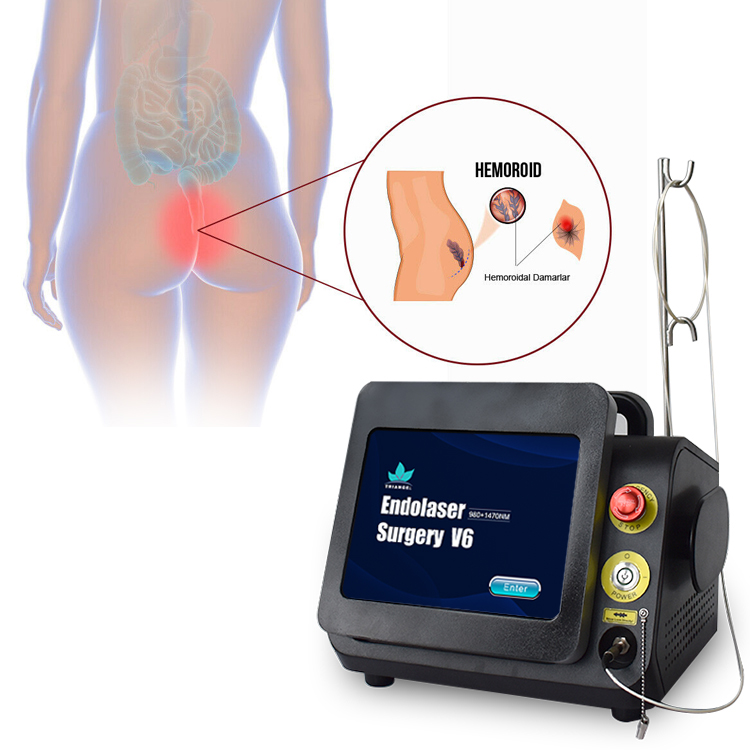 Baoding Te'anzhou Electronic Technology Co., Ltd. Proctology laser 980nm 1470nm Hemorrhoids pilonidal sinuse fistulas machine