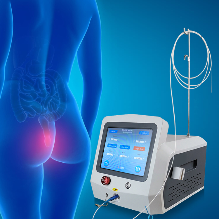 Triangel Laseev Minimally invasive surgery Anal Fistula Hemorrhoids SMA905 Fiber Laser Thermal Ablation machine 1470nm 980nm