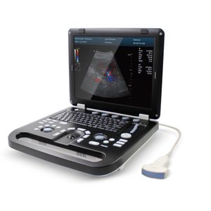 Contec CMS1700C Color Doppler Ultrasonic Diagnostic System usg machine