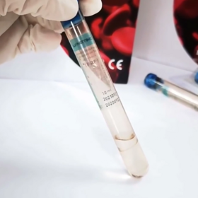 LONGTIME Hot Sale Platelet Rich Plasma Blood Tube Lab Test PRP Tube 10ml