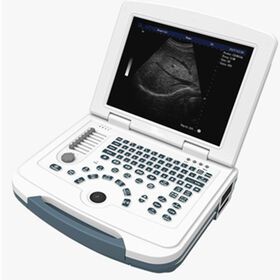 Good price portable ultrasound scanner laptop medical ultrasound machine price Ultrasound imaging detector