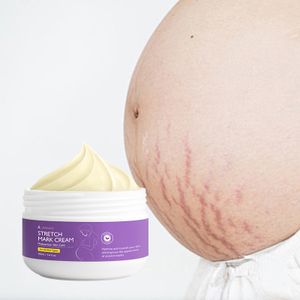 Custom Private Label Burn And Scald Acne Mark Surgical Scar Skin Repair Acne Treatment Fade Stretch Marks Scar Remover Cream