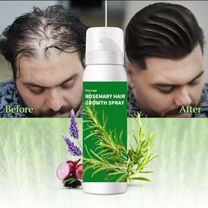 Private Label rosemary mint oil hair growth organic natural rosemary essential oil hair growth oil for black women