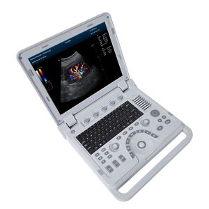 CONTEC CMS1700A cheap price medical ultrasound instruments cardiotocography china ultrasound machine