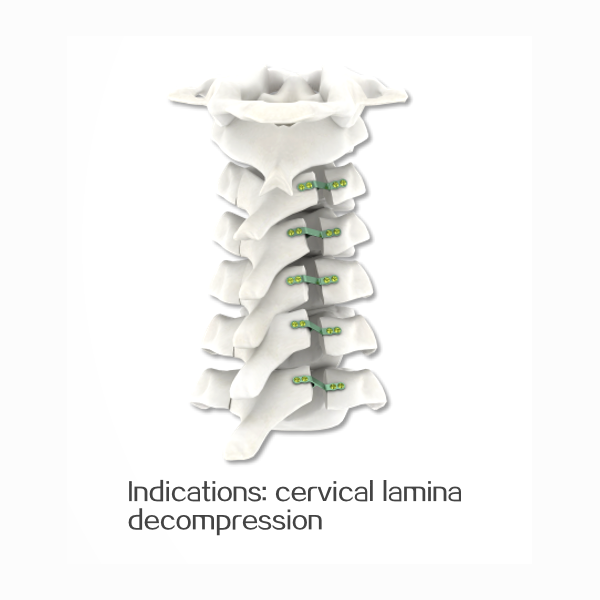 Implant Surgical Kit Orthopaedic Instrument LaminarShapping Plate Quality Management Certified Spinal Implants