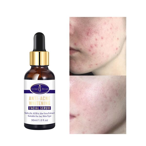 Aichun Beauty Products Organic Facial Serum With Aloe Vera Acne Remover Smooth Skin Care Products Brightening Face Serum