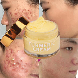private label organic skin care whitening moisturizer acne black spot remover vitamin c turmeric face cream
