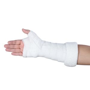 2024 New Orthopedic Ortho Equipment Thermoplastic Can be Reshaped White Injury Post op Polyester Casting Tape