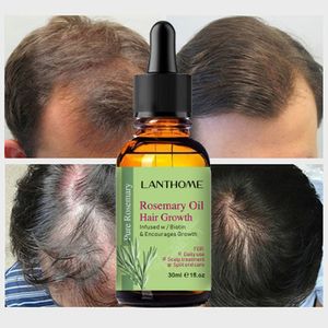 Trending Products Rosemary Oil Hair Growth Nourish Deeply Reduce Hair Loss Smooth And Fluffy Anti Hair Loss Oil