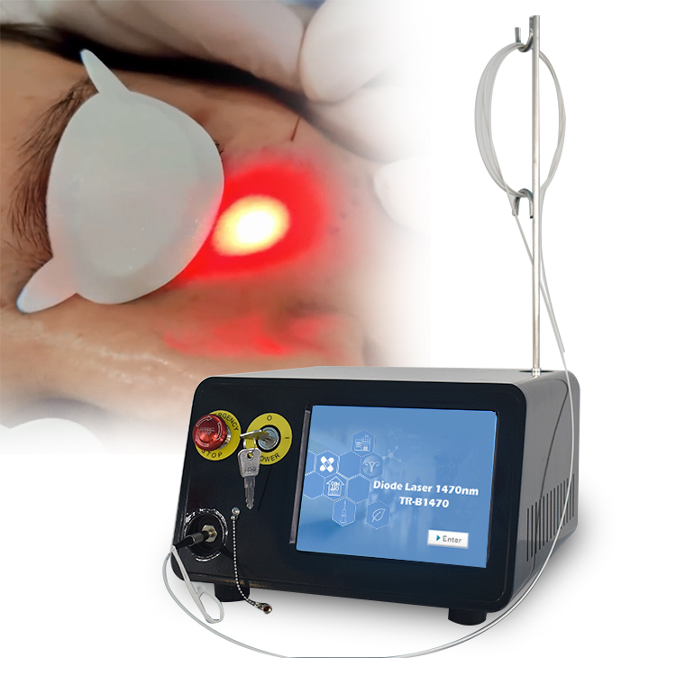 Baoding Te'anzhou Electronic Technology Co., Ltd. 1470nm Face Life Lipolysis Laser 1470nm Laser Fiberlift Machine