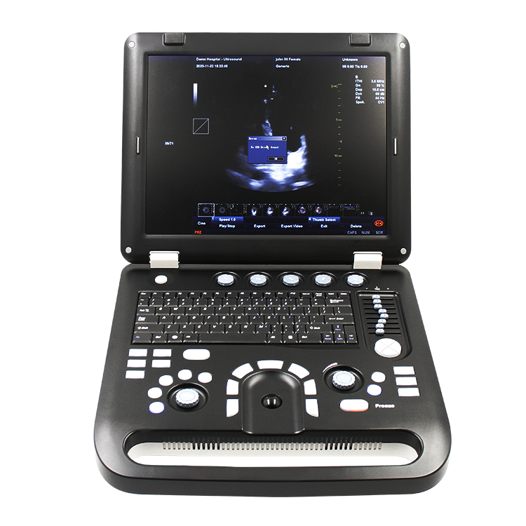 CONTEC CMS1700C medical ultrasound instruments gynecology ultrasound