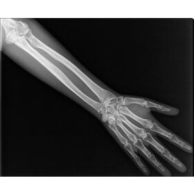mri scanner machine x ray film numeric medical film x-ray