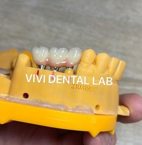 Implant Zirconia Crown and Bridge - China Dental Lab of Good Quality and Professional Technicians