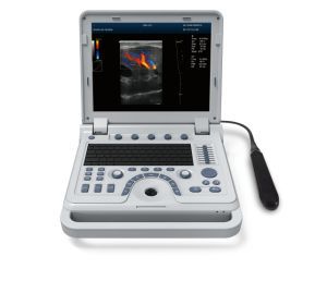 Contec Cms1700b Medical 4D Color Doppler Portable Ultrasound Scanner Ultrasound Machine