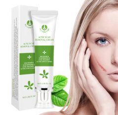 Face Scar Removal Cream