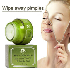 Anti Acne cream