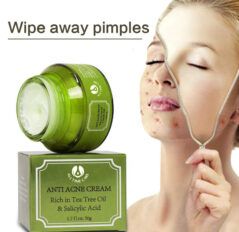 Anti Acne cream