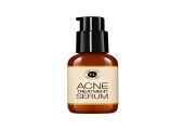 Acne Treatment Serum