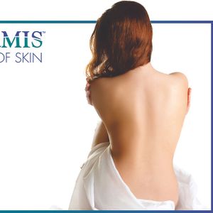 Silicone Y tế Chống sẹo Biodermis