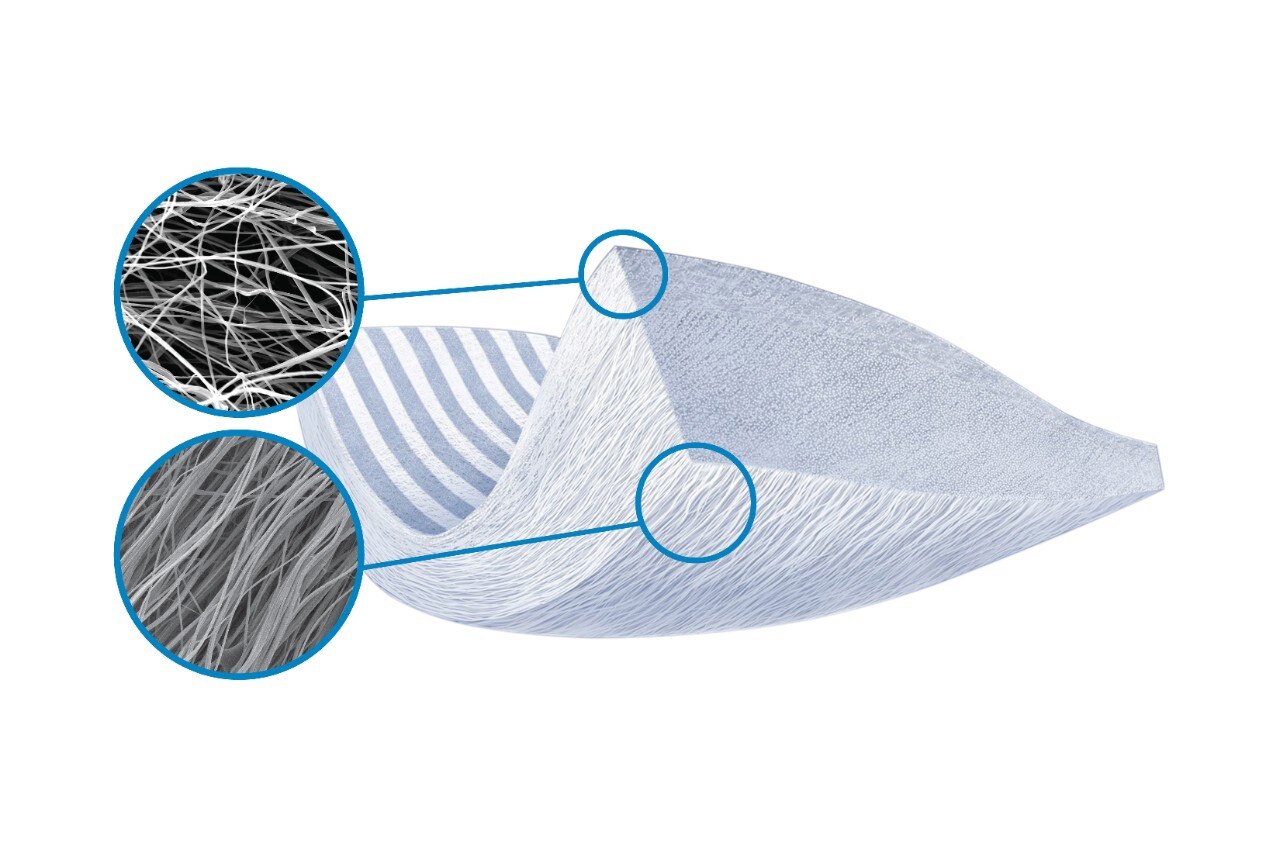 Tapestry® Biointegrative Implant