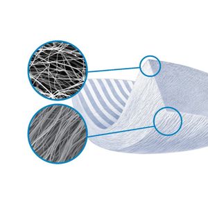 Tapestry® Biointegrative Implant