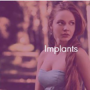 IMPLANTS