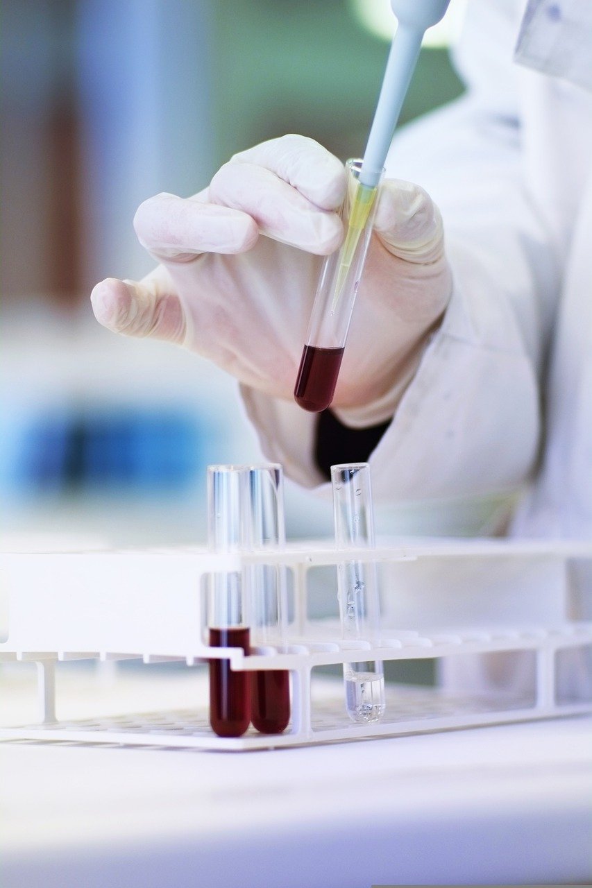 PRIME LAB S.R.L. Cholesterol reagents