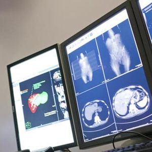 advanced molecular imaging