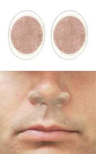 First Defense Nasal Screens