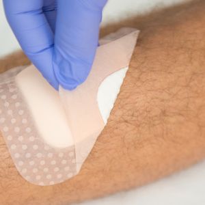 advanced wound care