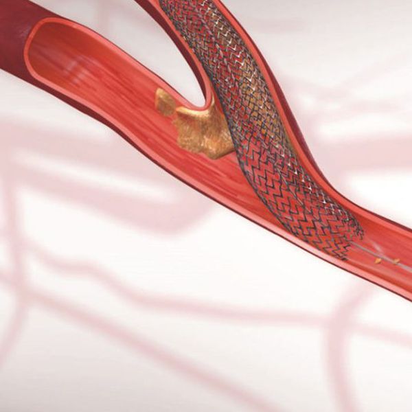 medical device components