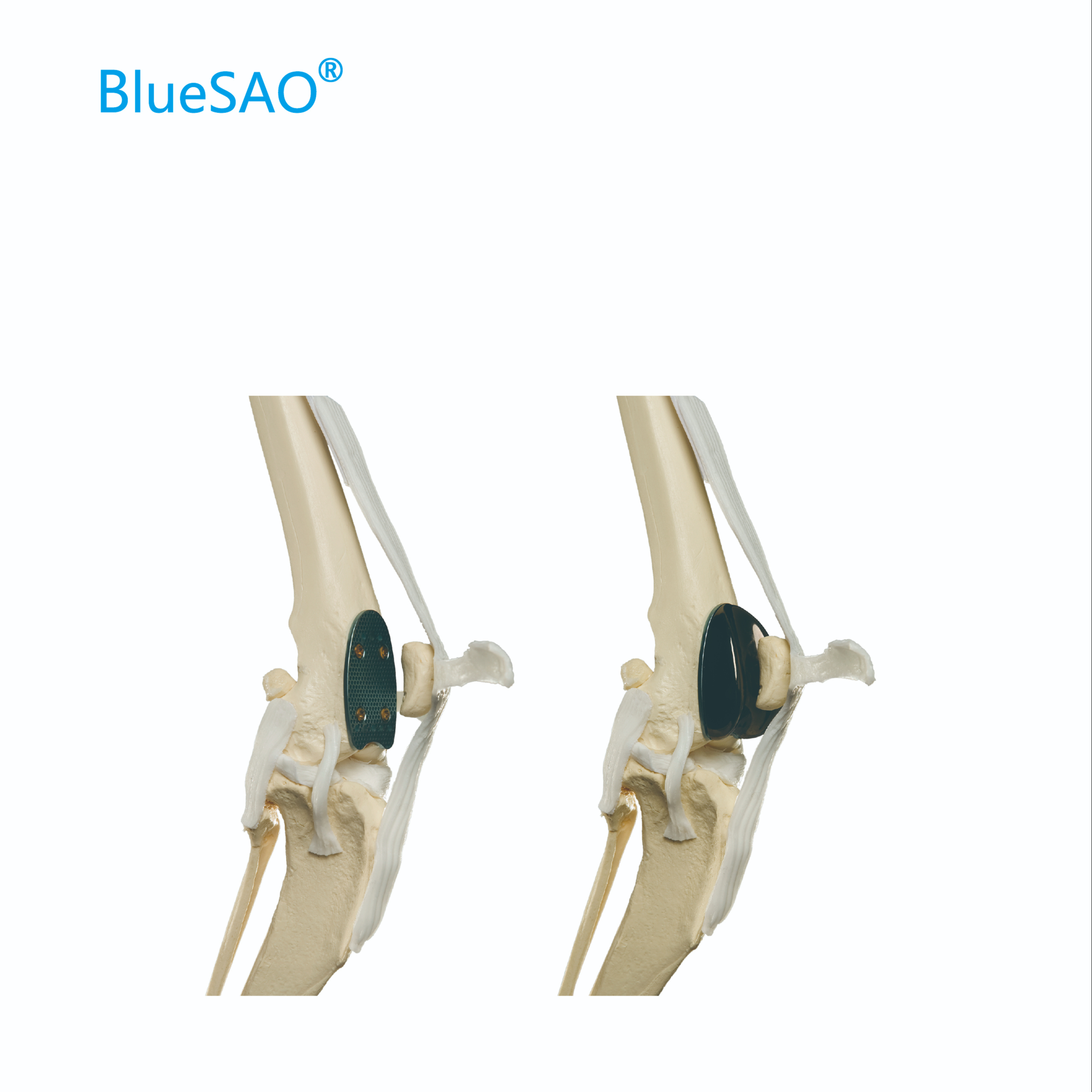 Patellar Groove Replacement Kit Implant Prosthesis and Trial Prothesis Size 9 Veterinary Orthopedic Instrument