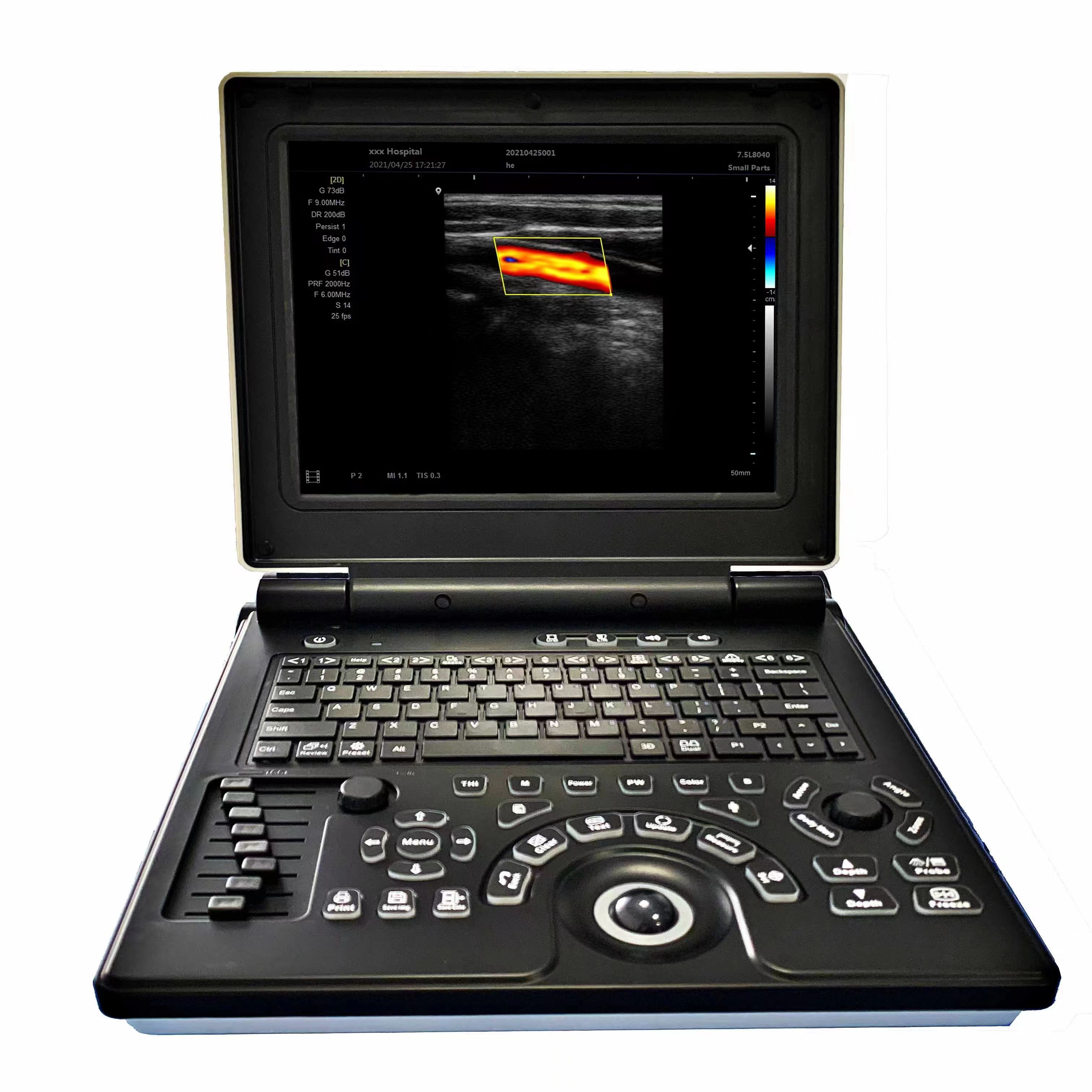 Hospital Clinic Ultrasound Manufacturing Laptop Ecocardiografo 2D 3D 4D 5D Color Doppler Ultrasound Machine
