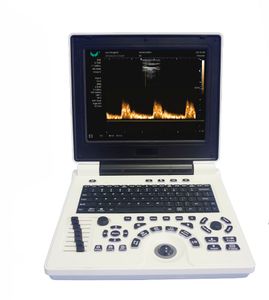 Medical Equipment  B/W Ultrasound Scanner Ultrasound System Notebook Ultrasound Machine With Diagnostic 4D Technology