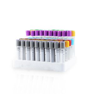 Medical Vacuum Blood Collection Tube Ce Approval Edta Tube