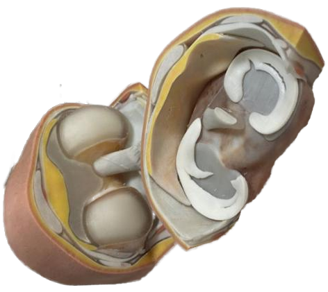 3D Printing Model  3D Printing Meniscus Injury Structure  Anatomical Structures Model
