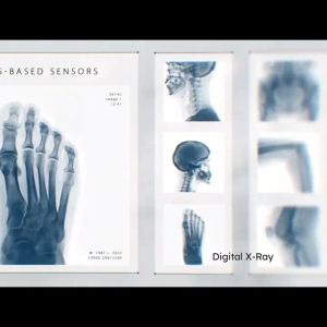 CMOS-Based Sensors for Digital X-Ray