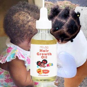 Natural Vegan Peach Baby Kids Hair Growth Products Extra Strength Growing Nourishing Children Care Serum Unisex Hair Growth Oil
