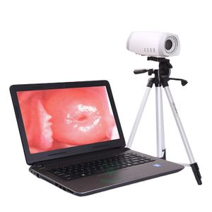 MY-F003 Medical gynecology portable mini digital video colposcope for vagina