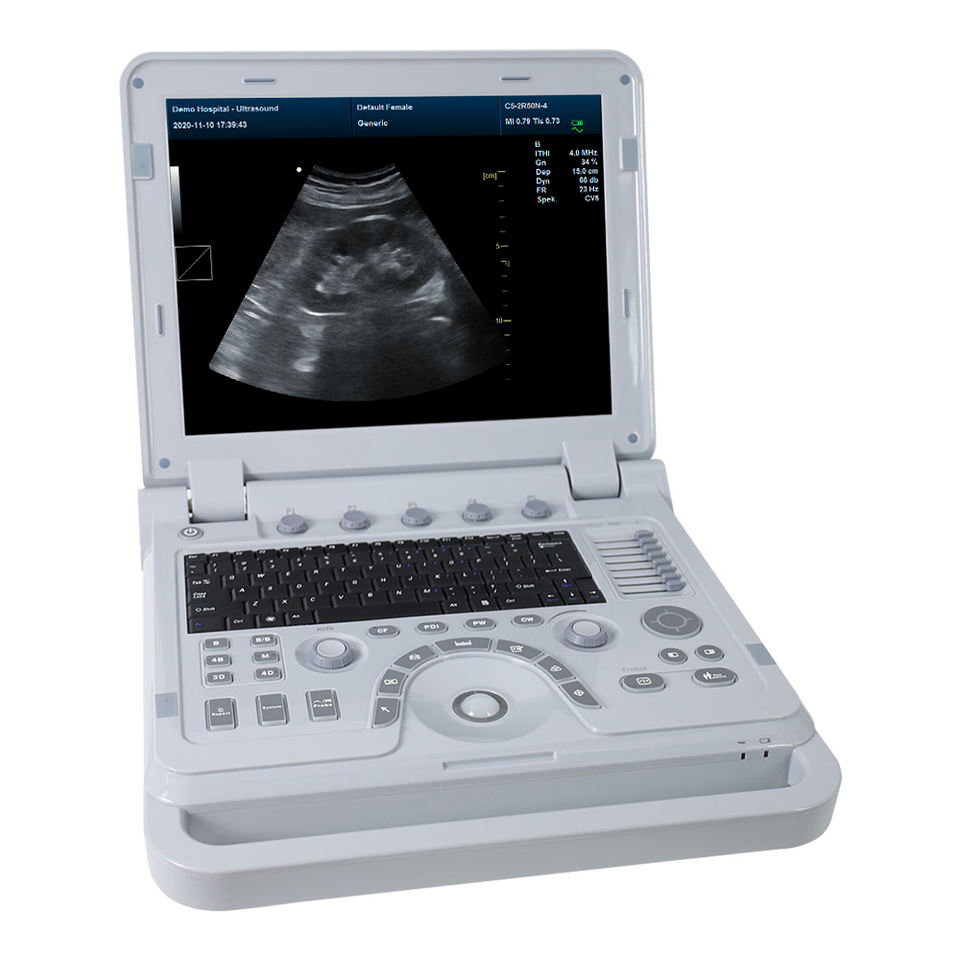 CMS1700B 3D 4D color Hand-carried Diagnostic Imaging ultrasound machine price
