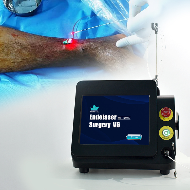 Baoding Te'anzhou Electronic Technology Co., Ltd. Spider vein telangiectasis varicose lesion removal laser machine 980nm 1470nm wavelength