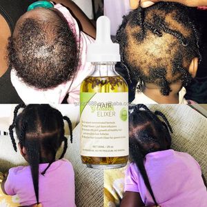 Custom Logo Natural Organic Hair and Scalp Ayurvedic Oil Deep Treatment Baby Hair Growth Oil For Kids Regrowth