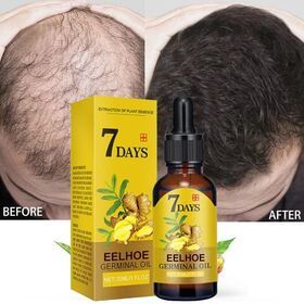 Hair Growth Products Ginger Fast Growing OEM Oil Beauty Hair Care Prevent Hair Loss Oil Scalp Treatment For Human