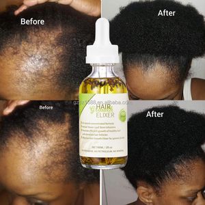 Private Label 100% Natural Organic Rosemary Castor Almond Oil Men Women Scalp Care Serum Hair Treatment Growth Oil