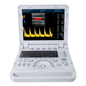 CONTEC CMS1700A colour doppler cardiac ultrasound scanner  portable ultrasound table usg machine