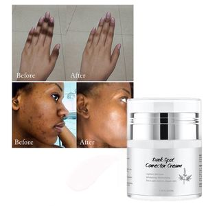Private Label Strong Effective Romover For Anti-Aging Freckle Lighten Skin Tone Dark Spot Corrector Cream